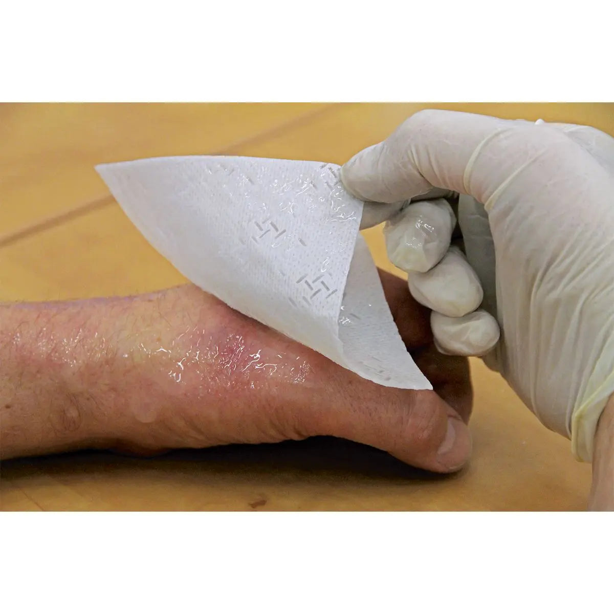 Sealey Burn Relief Dressing 